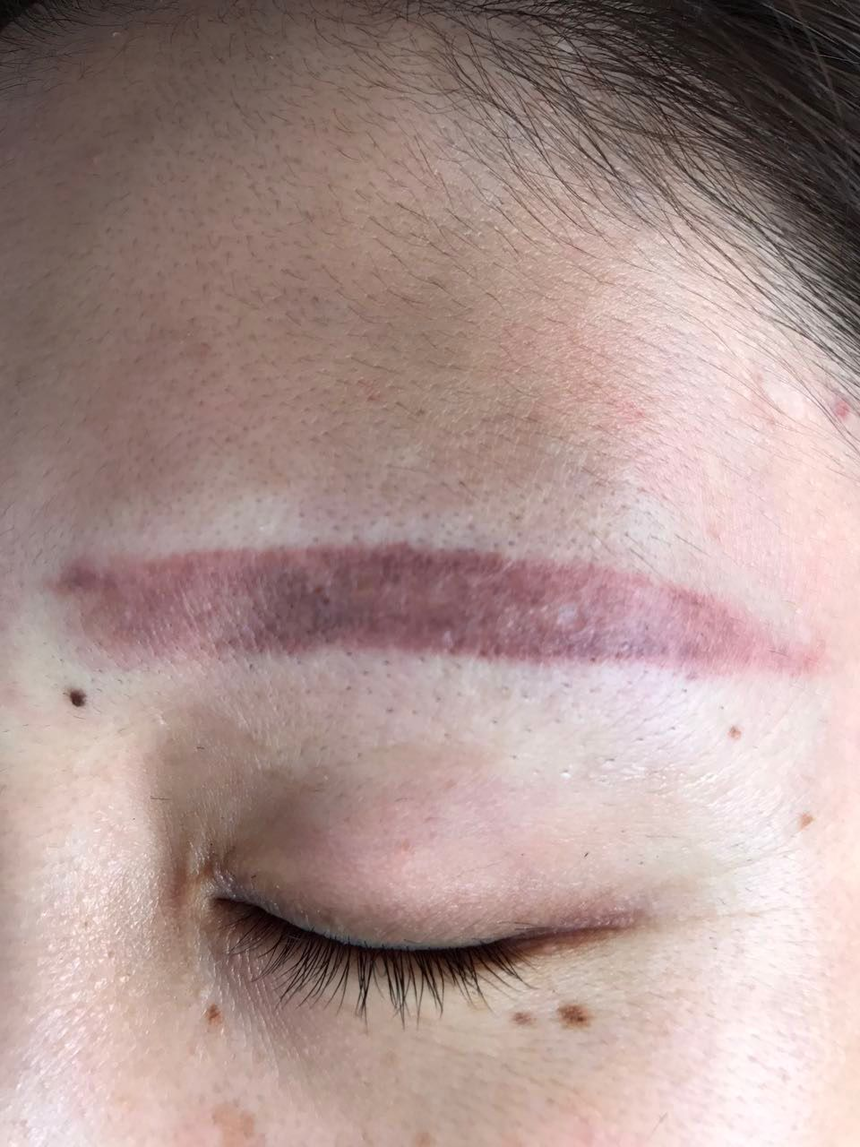 什么万能粉遮盖,红色纹眉,咖啡色纹眉,反复纹洗留下的疤痕祛不掉怎