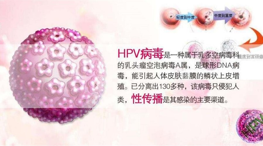 中药治疗感染"人乳头瘤病毒(hpv)"案例分享