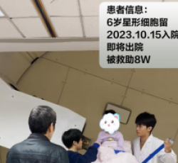 星形细胞瘤瘤