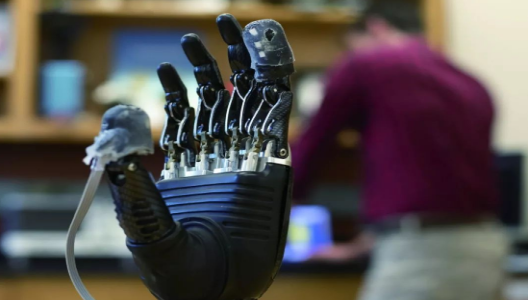 假肢也能感到痛,你相信嗎?