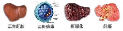 u=3764010540,3150808955undefinedfm=26undefinedgp=0.jpg