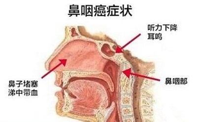 u=907573511,2367117688&fm=26&gp=0.jpg