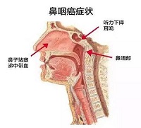 u=647240304,1117151876&fm=26&gp=0.jpg