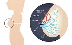 ob004_mastitis_img2_au_v2.jpg
