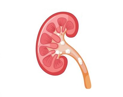 diagram-of-kidney-with-disease-vector.jpg