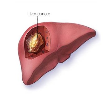 common-liver.jpg