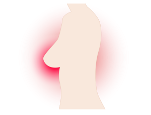 breast-g39dbdf6b1_1920.png