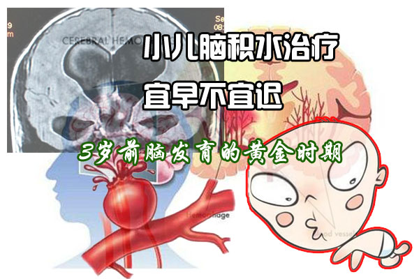 小儿脑积水3岁-1.jpg