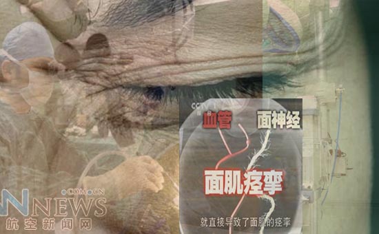 1546423987646698.jpg 1面肌痉挛-压迫3.jpg