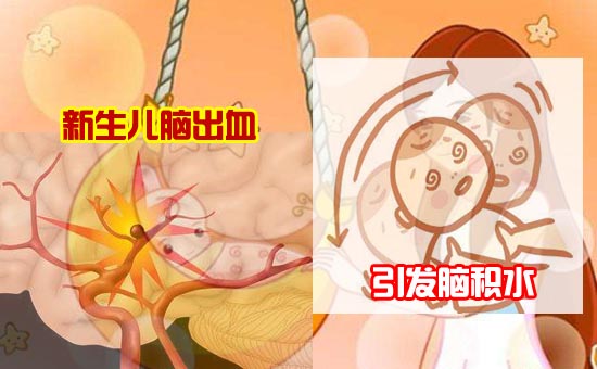 1546508934715293.jpg 1新生儿脑出血-1.jpg