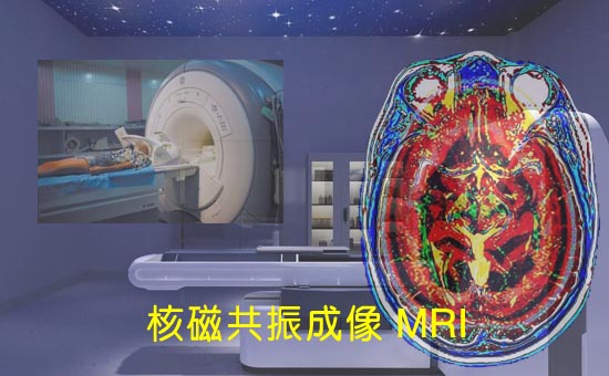 1MRI-1.jpg