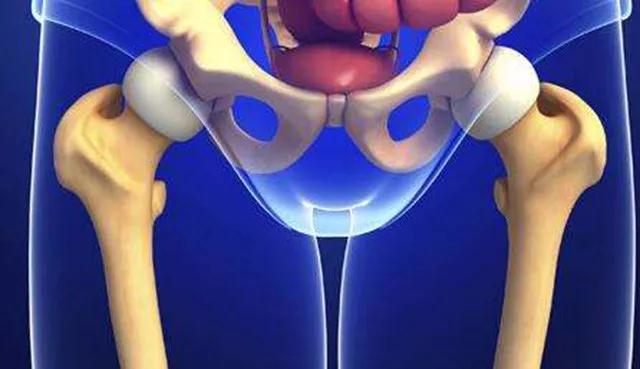 股骨头已坏死,如何保住髋关节?