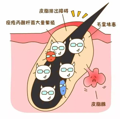 DƬ3.png