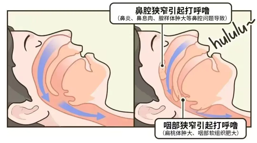 640.webp (1).png