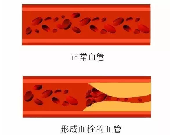 ad1ac151302240108a964aae1e914bd0.jpg