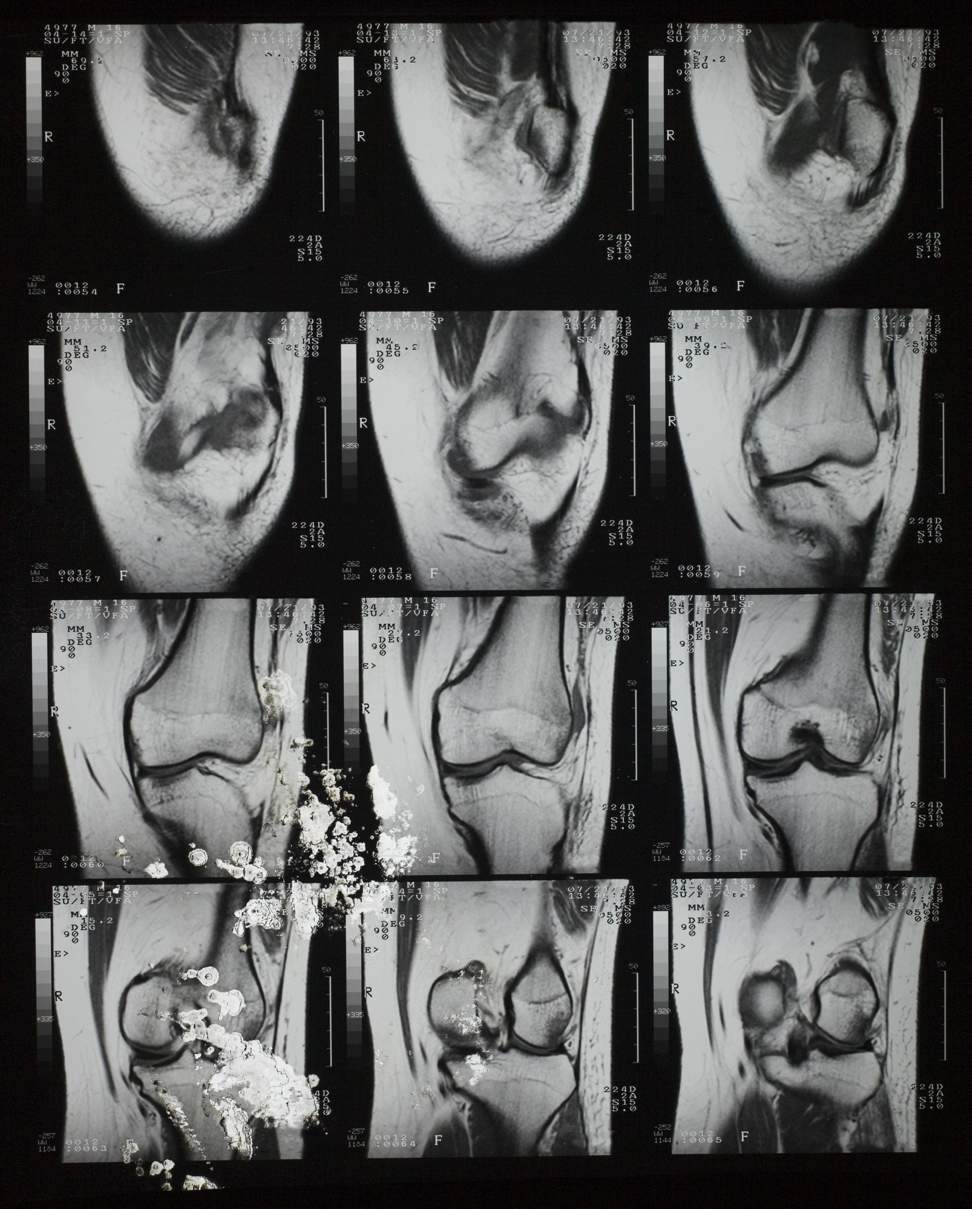 X-CTŹ (1).jpg