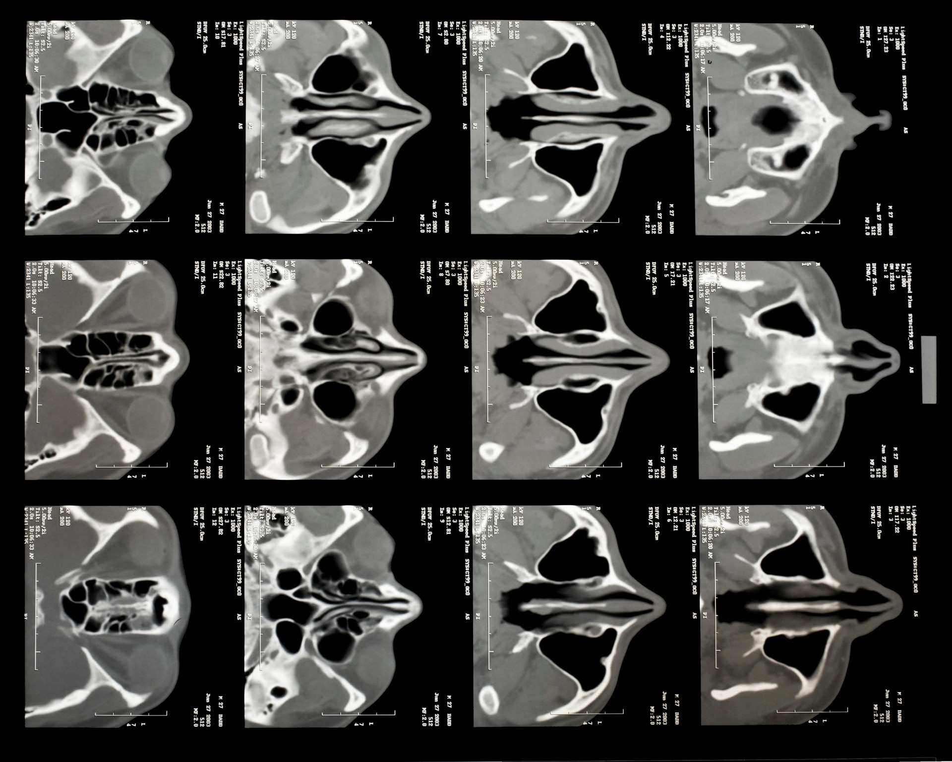 X-CTŹ (2).jpg