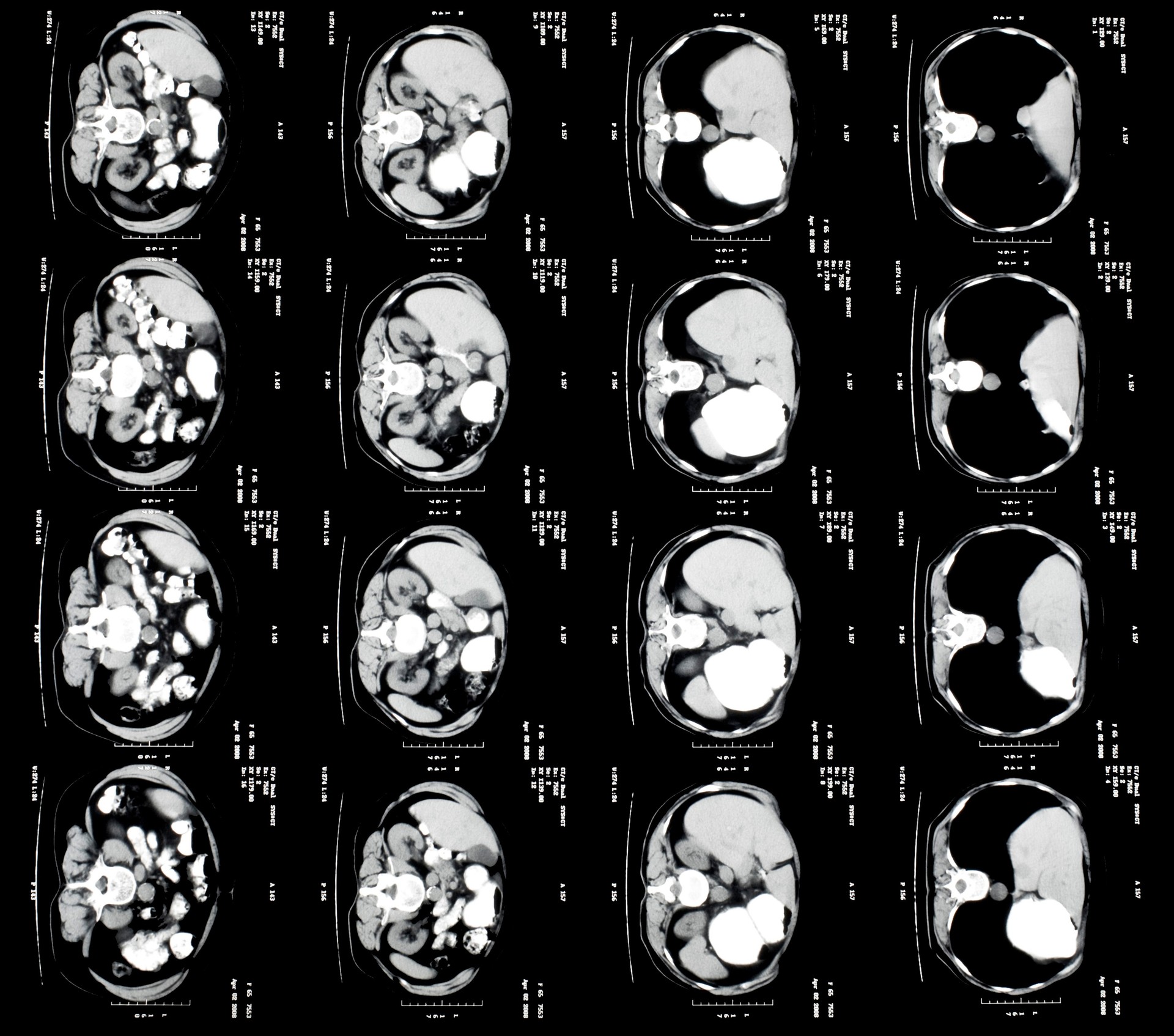 X-CTŹ (4).jpg