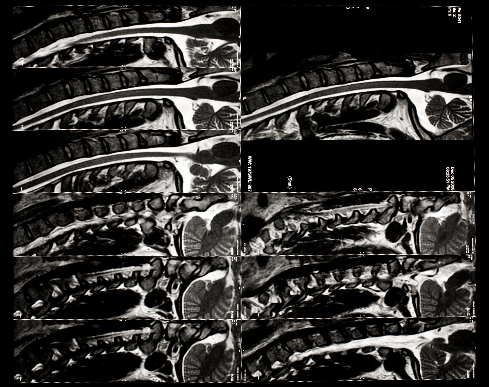 X-CTŹ (5).jpg