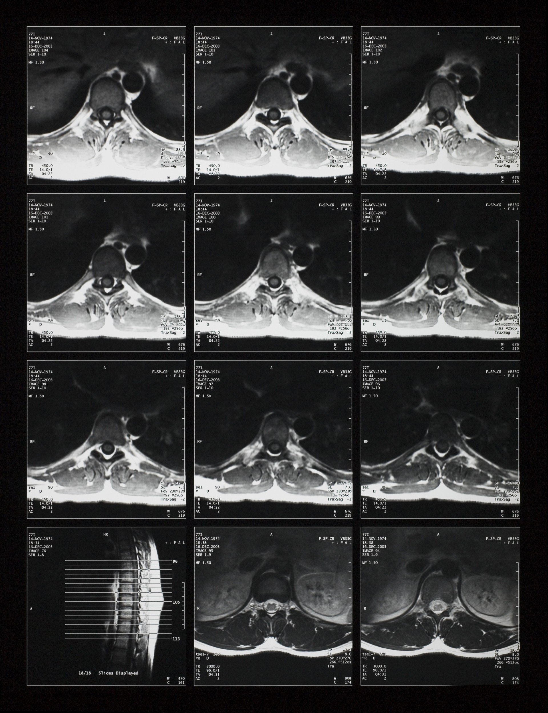X-CTŹ (13).jpg