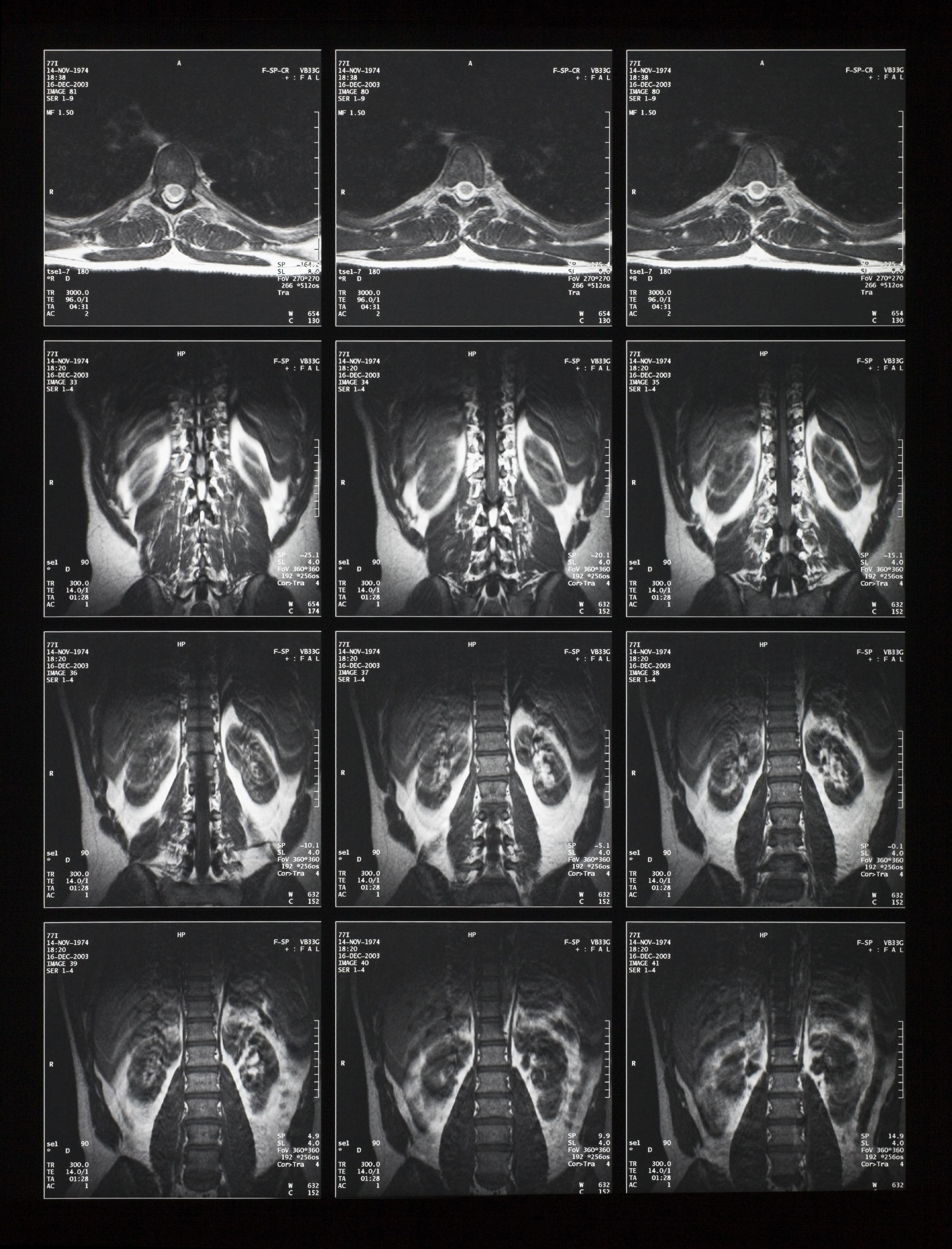 X-CTŹ (15).jpg