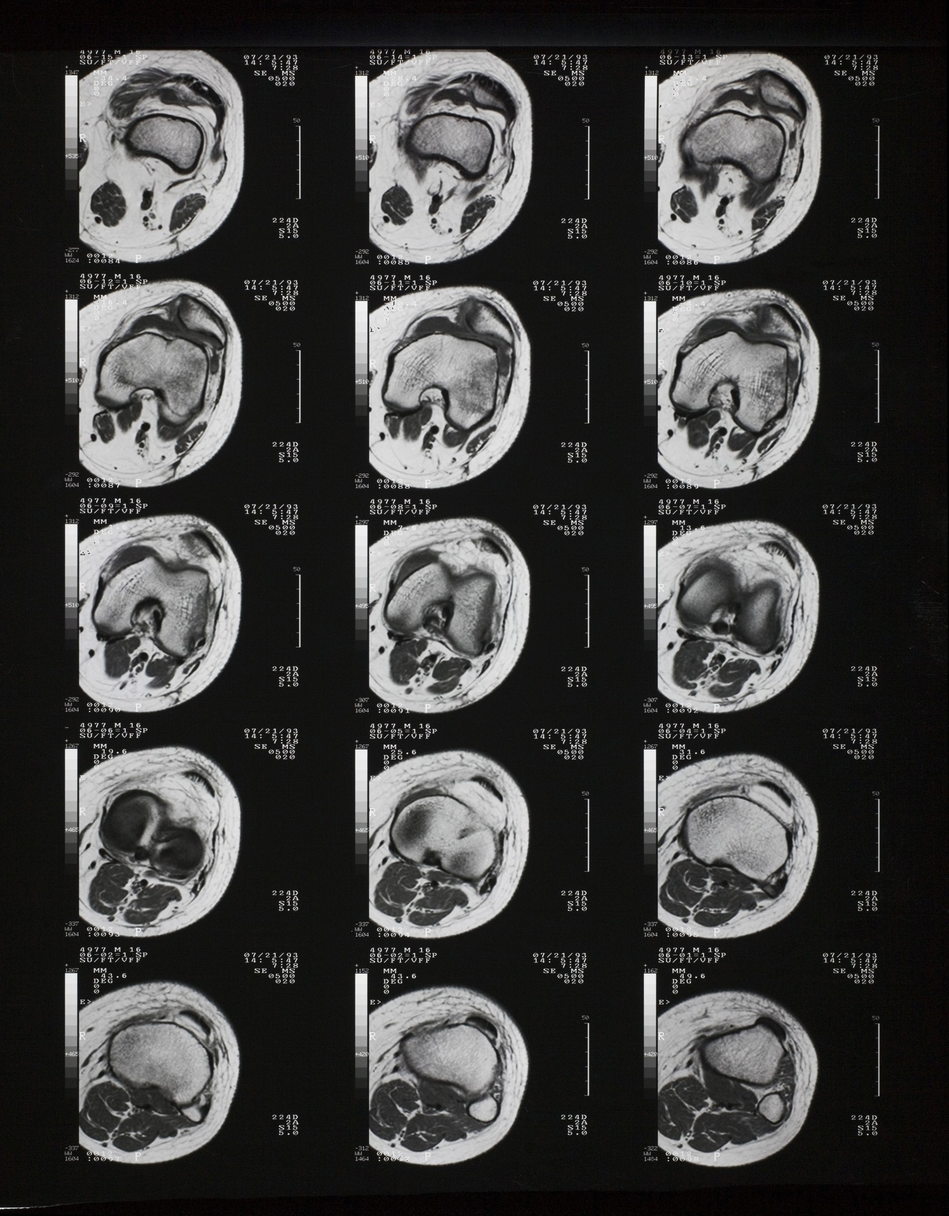 X-CTŹ (18).jpg