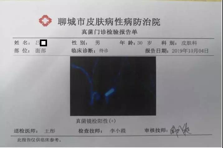 "难辨认癣"的诊断与治疗_聊城市皮肤病防治院