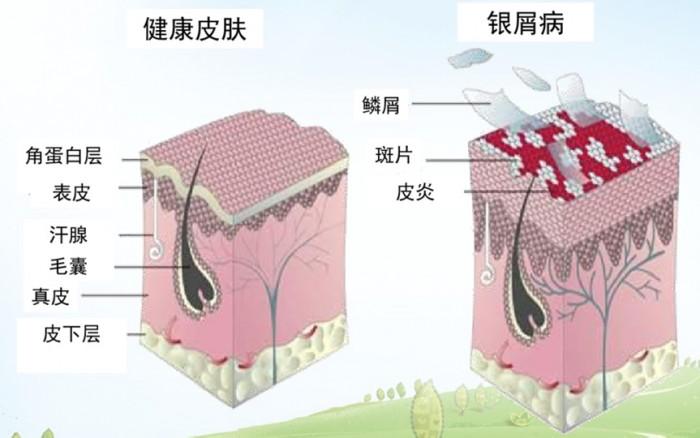 src=http_%2F%2Fdrdbsz.oss-cn-shenzhen.aliyuncs.com%2F1908151524071690084279.jpg&refer=http_%2F%2Fdrdbsz.oss-cn-shenzhen.aliyuncs.jpg