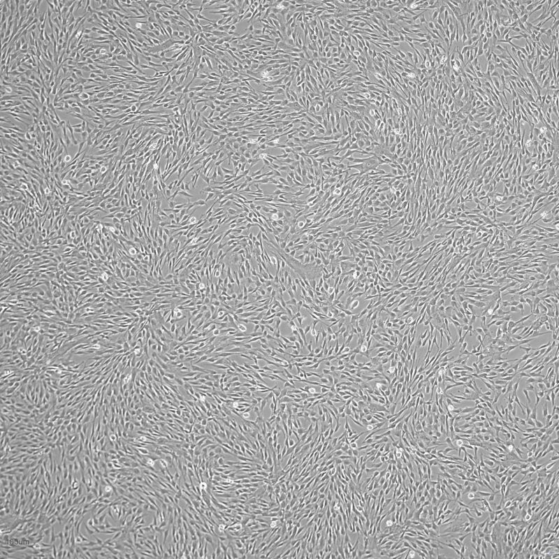 人羊膜间充质干细胞（科研）