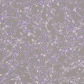 人臍帶間充質干細胞（科研）
