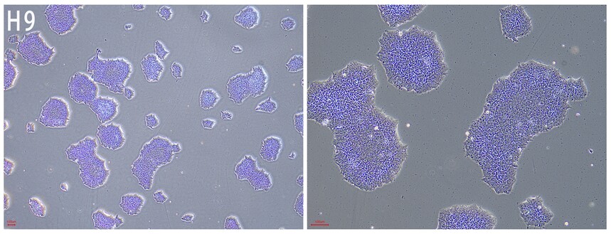 RC200120 ES/iPS������.jpg