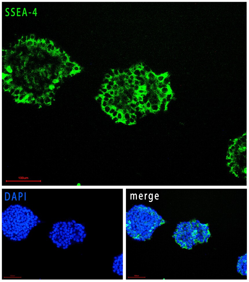 RC200120 ES������ SSEA-4.jpg
