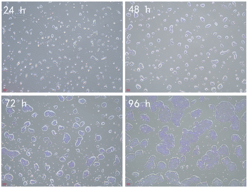 RC200120 ES������ FyPluri.png