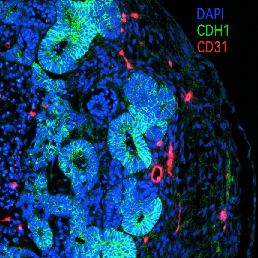 D26 CD31-594+E-cad-488 -Region 004-FOV 00461-DAPI-1.jpg