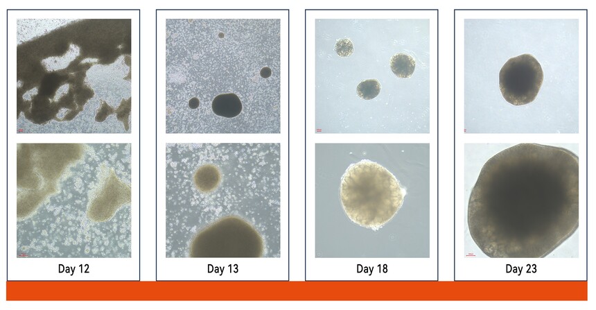 弗元生物 fuyuanbio RC200134 肾类器官试剂盒 弗元生物 fuyuanbio RC200134 肾类器官试剂盒