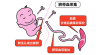 新生儿干细胞存储库公共好还是自存好