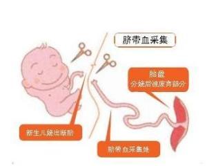脐带血 脐带血