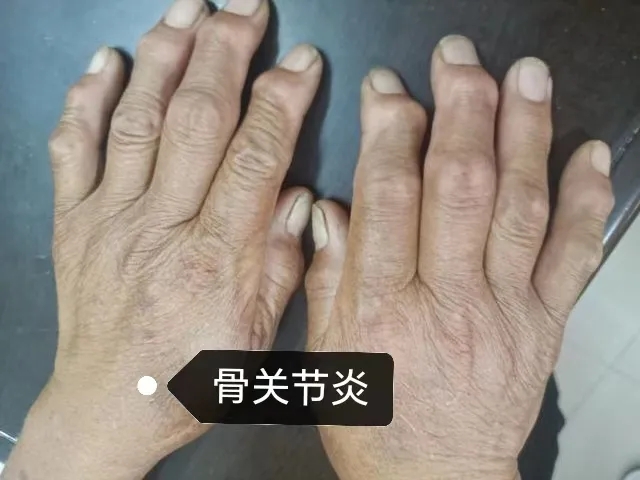 ؽڣԶؽסʪ߿ƹ淶ƹؽ.webp.jpg