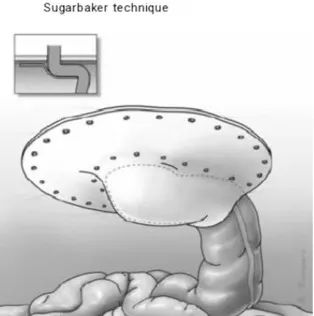 ƶ^(q)޸ǻRSugarbakerag(sh).jpg