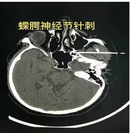 IMG_20261008_204404.png