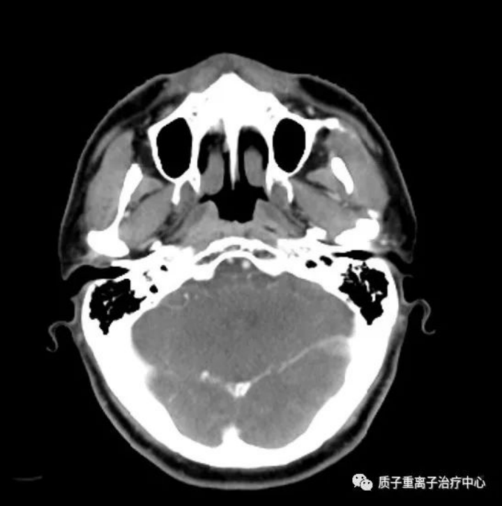 image.gif