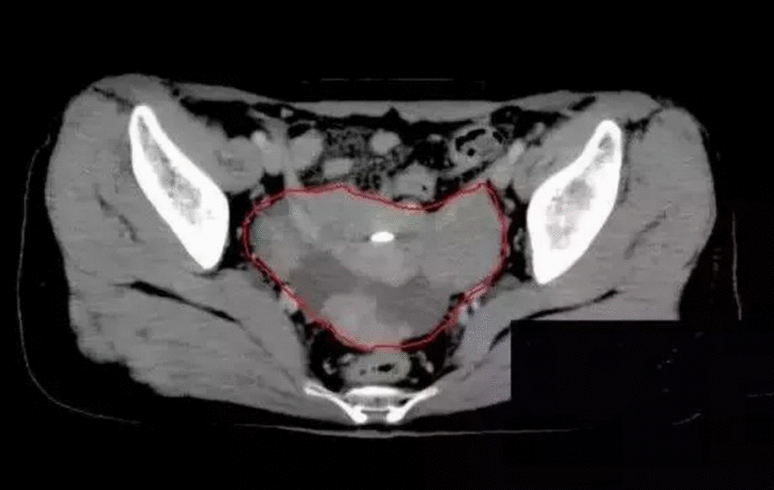 image.gif