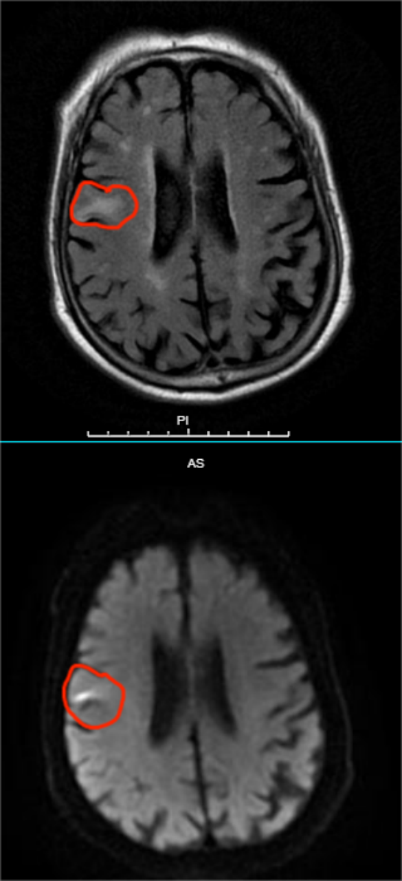 image.gif