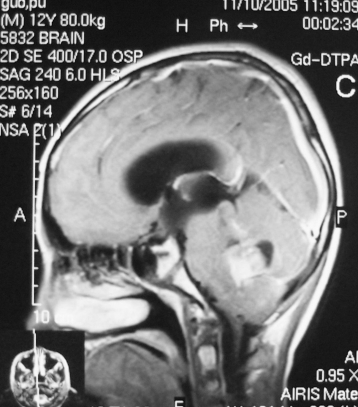 image.gif