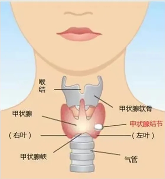 202408262.webp.jpg