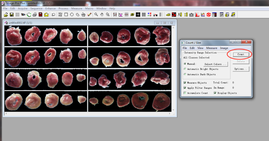 TTC染色详细计算分析过程,步骤详解(组图)