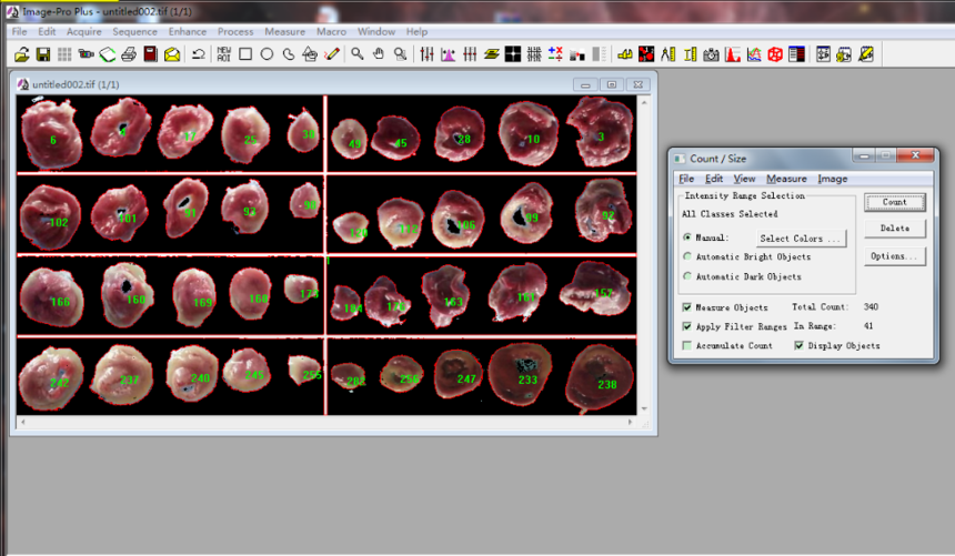 TTC染色详细计算分析过程,步骤详解(组图)