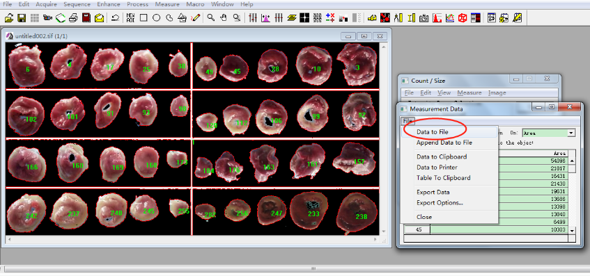 TTC染色详细计算分析过程,步骤详解(组图)