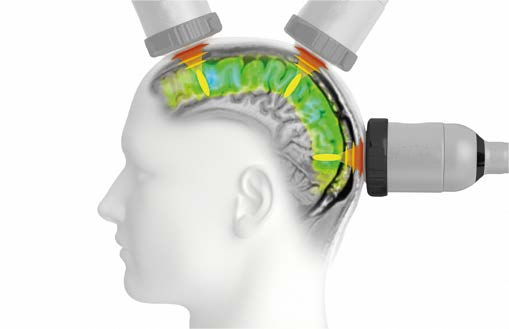 1721876526281163.png 1721876526281163.png