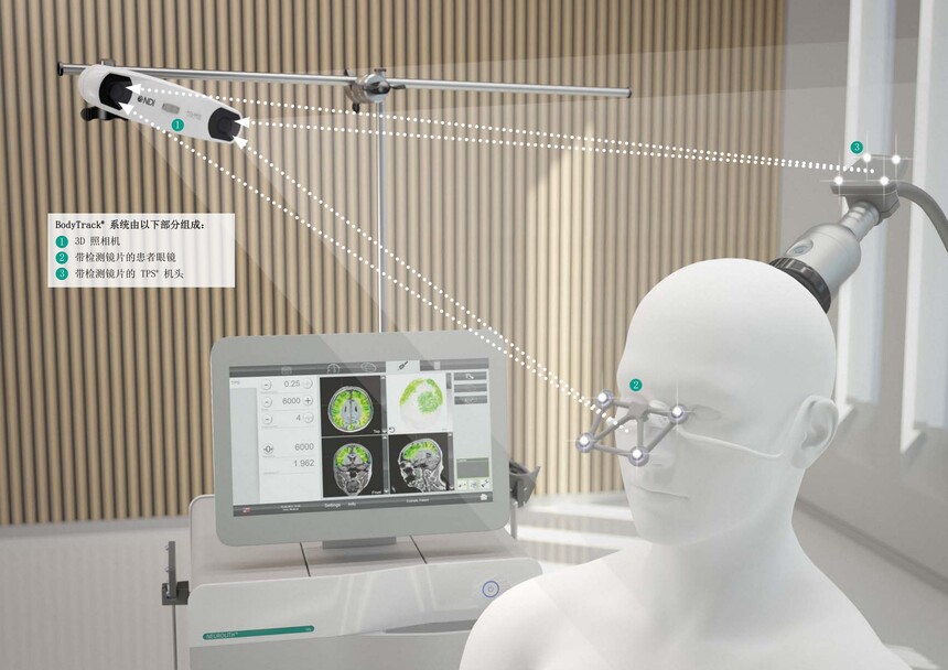 1722492368753589.jpg NeuroLith經(jīng)顱超聲刺激_07.jpg